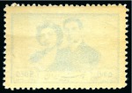 1951 2.50R Wedding and 1963 Freedom from Hunger 14R pair both showing light offsets on the reserves